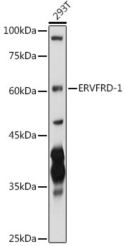 HERV-FRD Antibody in Western Blot (WB)