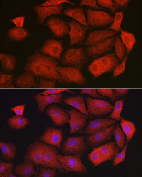 GAMT Antibody in Immunocytochemistry (ICC/IF)