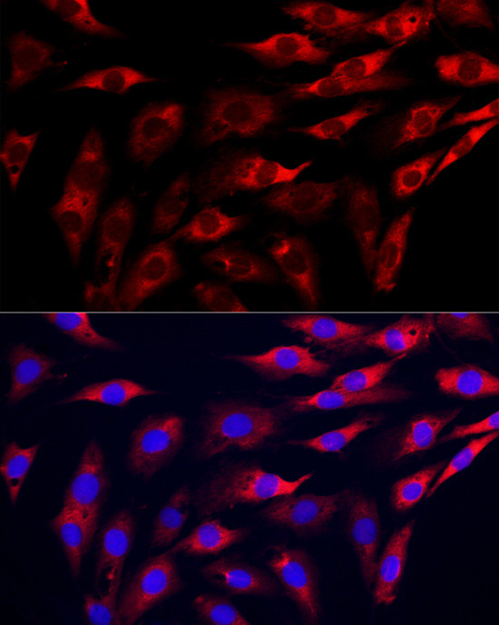 GAMT Antibody in Immunocytochemistry (ICC/IF)