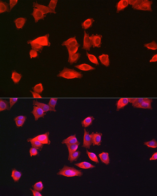 GAMT Antibody in Immunocytochemistry (ICC/IF)