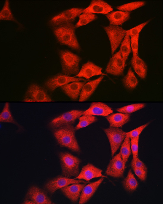 GAMT Antibody in Immunocytochemistry (ICC/IF)