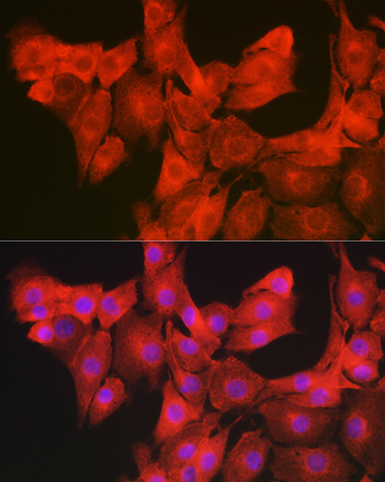 GAMT Antibody in Immunocytochemistry (ICC/IF)