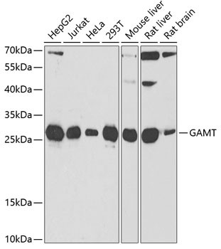 GAMT Antibody in Western Blot (WB)