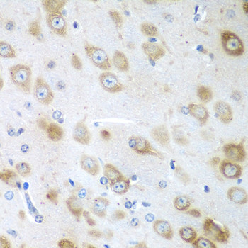 GFM1 Antibody in Immunohistochemistry (Paraffin) (IHC (P))