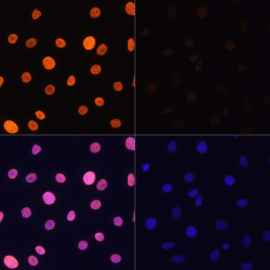 H3K4ac Antibody in Immunocytochemistry (ICC/IF)