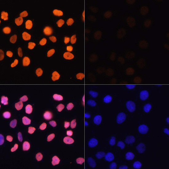 H3K4ac Antibody in Immunocytochemistry (ICC/IF)