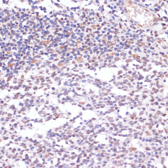 H3K23ac Antibody in Immunohistochemistry (Paraffin) (IHC (P))