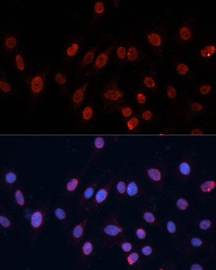 HNRNPU Antibody in Immunocytochemistry (ICC/IF)