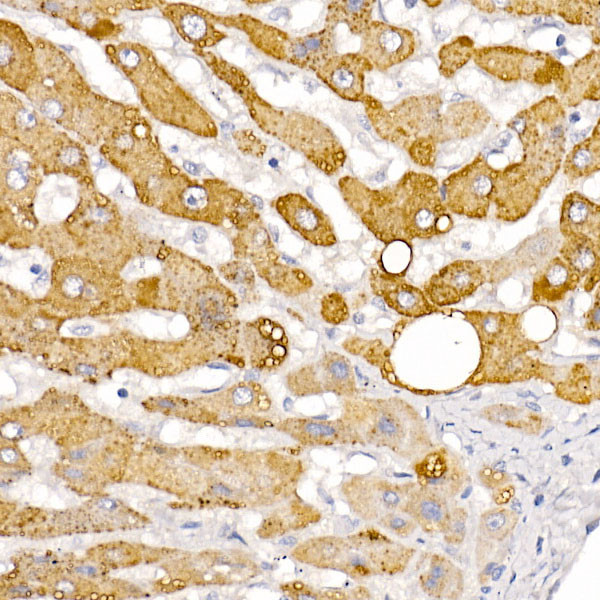 HSD17B13 Antibody in Immunohistochemistry (Paraffin) (IHC (P))