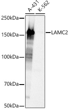 LAMC2 Antibody in Western Blot (WB)