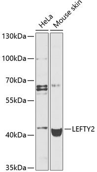 LEFTY2 Antibody in Western Blot (WB)