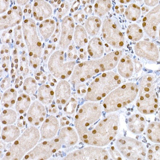 LIG3 Antibody in Immunohistochemistry (Paraffin) (IHC (P))