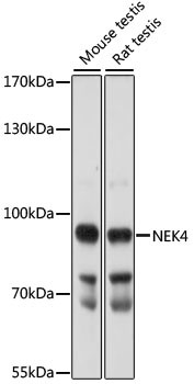 NEK4 Antibody in Western Blot (WB)