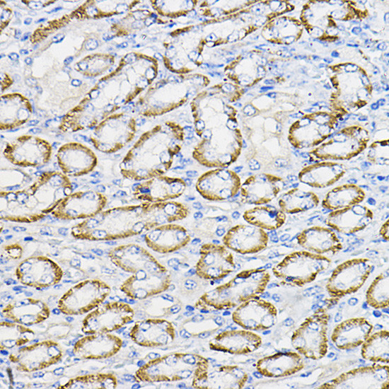 NUBP1 Antibody in Immunohistochemistry (Paraffin) (IHC (P))