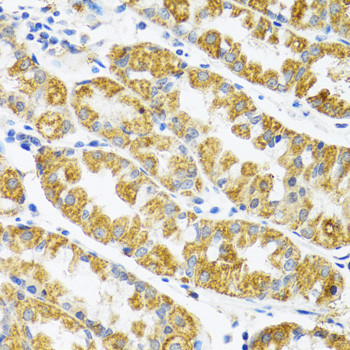 POLG2 Antibody in Immunohistochemistry (Paraffin) (IHC (P))