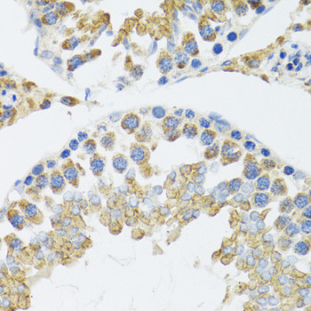 POLG2 Antibody in Immunohistochemistry (Paraffin) (IHC (P))