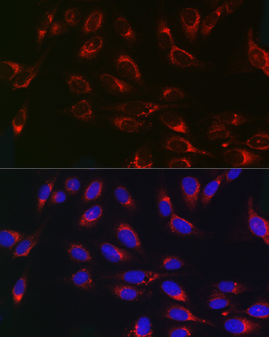 PSAP Antibody in Immunocytochemistry (ICC/IF)