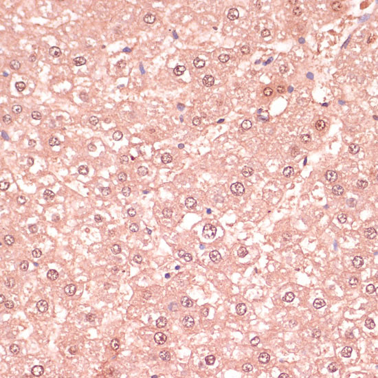 RNF5 Antibody in Immunohistochemistry (Paraffin) (IHC (P))