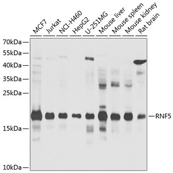 RNF5 Antibody in Western Blot (WB)