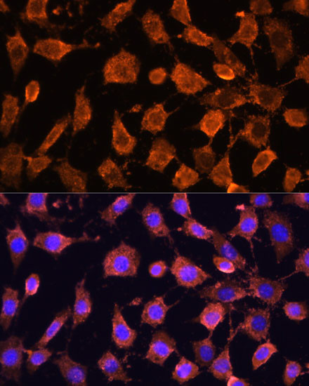 RPL11 Antibody in Immunocytochemistry (ICC/IF)