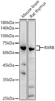 RXRB Antibody in Western Blot (WB)