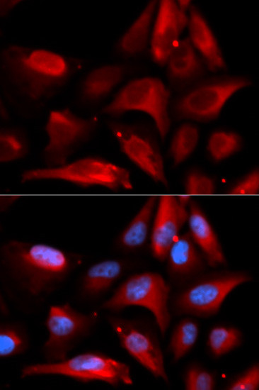 S100A11 Antibody in Immunocytochemistry (ICC/IF)