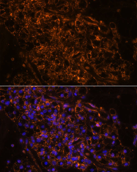 SCNN1G Antibody in Immunohistochemistry (Paraffin) (IHC (P))