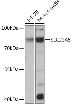 SLC22A5 Antibody in Western Blot (WB)