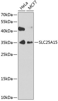 ORNT1 Antibody in Western Blot (WB)