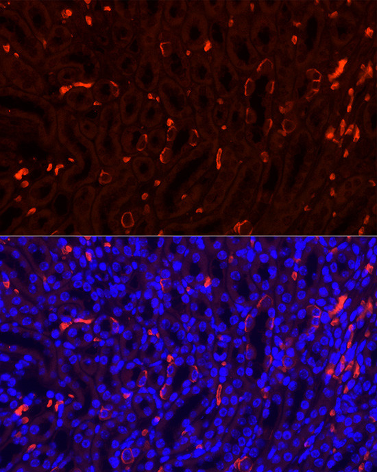 SLC4A1 Antibody in Immunohistochemistry (Paraffin) (IHC (P))