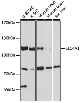 SLC4A1 Antibody in Western Blot (WB)