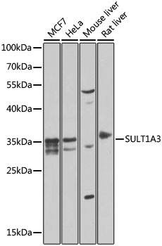 SULT1A3 Antibody in Western Blot (WB)