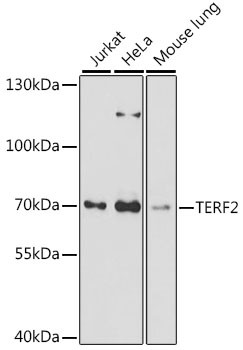 TERF2 Antibody in Western Blot (WB)