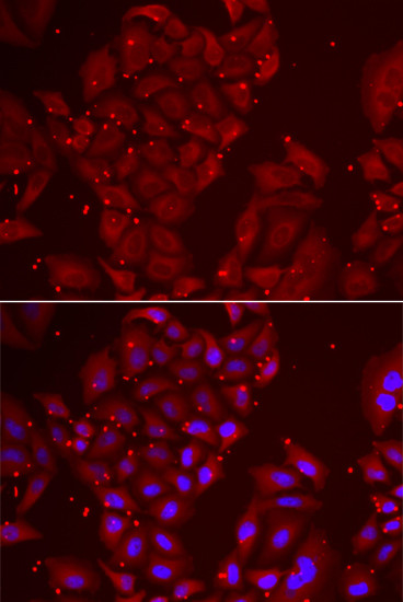 TPP2 Antibody in Immunocytochemistry (ICC/IF)