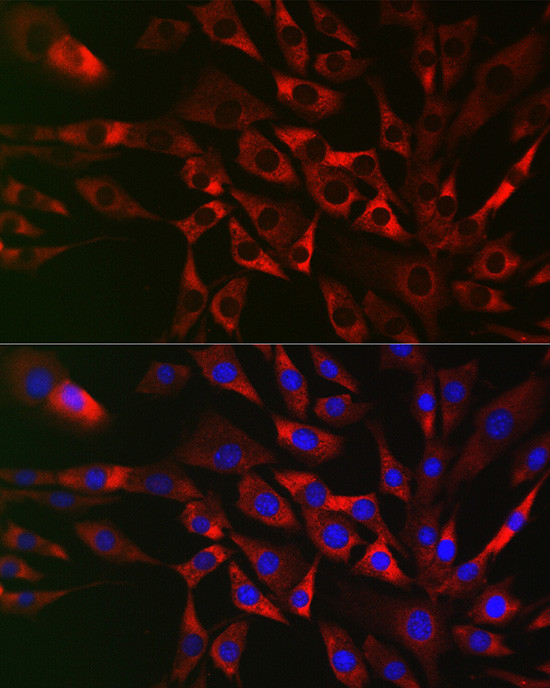 TRAF3IP2 Antibody in Immunocytochemistry (ICC/IF)