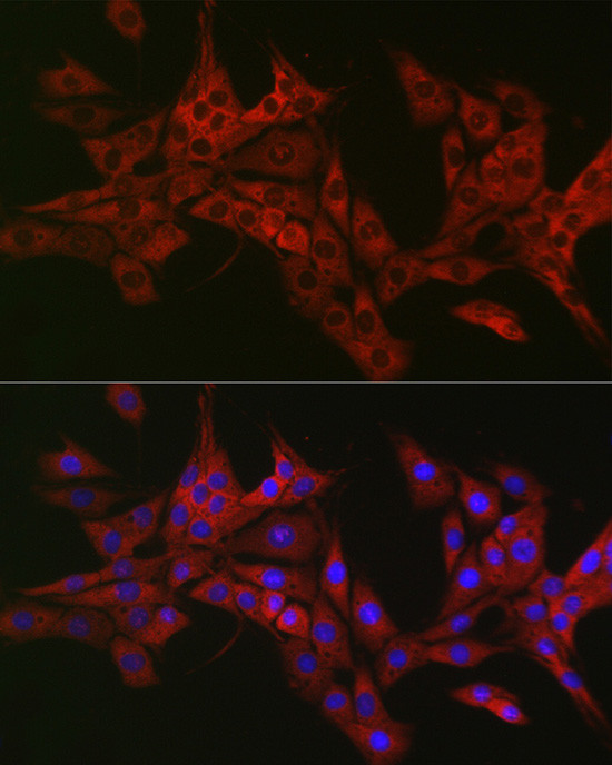 TRAF3IP2 Antibody in Immunocytochemistry (ICC/IF)