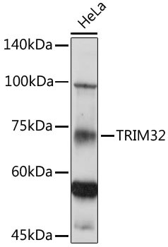 TRIM32 Antibody in Western Blot (WB)