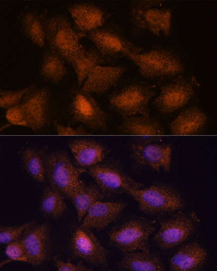 UPF3A Antibody in Immunocytochemistry (ICC/IF)