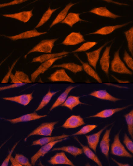 UPF3A Antibody in Immunocytochemistry (ICC/IF)