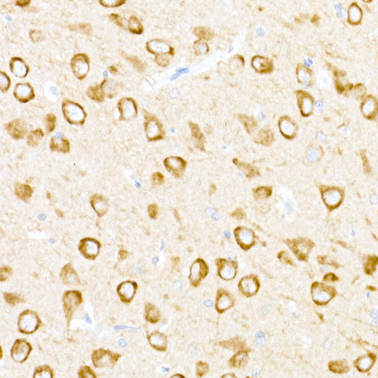 USP18 Antibody in Immunohistochemistry (Paraffin) (IHC (P))