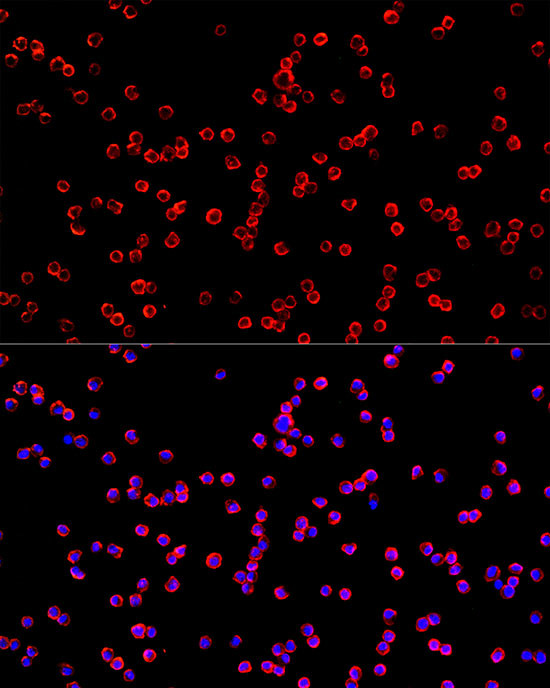 USP21 Antibody in Immunocytochemistry (ICC/IF)