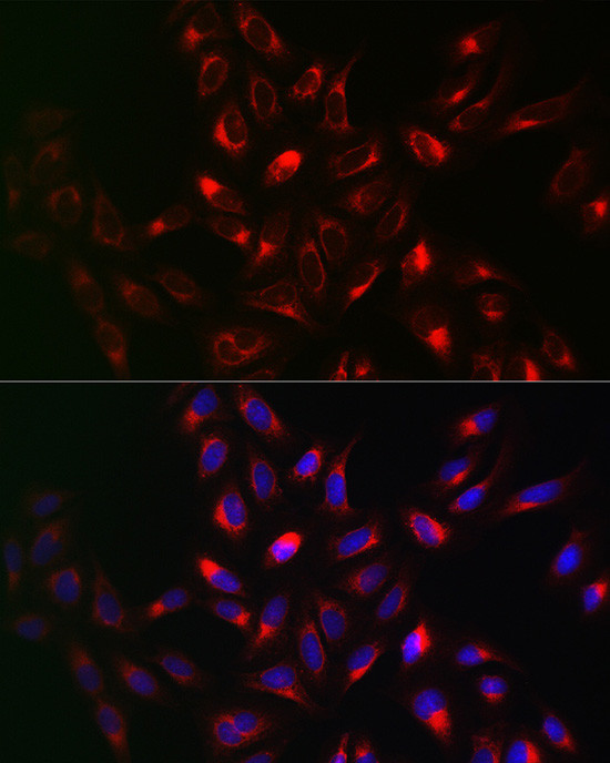 VAPB Antibody in Immunocytochemistry (ICC/IF)