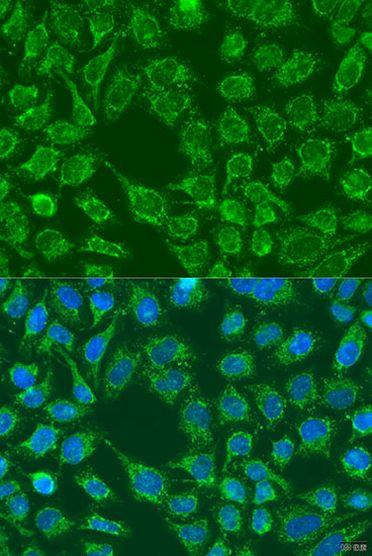 WNT7B Antibody in Immunocytochemistry (ICC/IF)