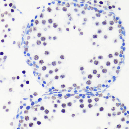 H3R8me1 Antibody in Immunohistochemistry (Paraffin) (IHC (P))