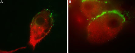 GluR1 (extracellular) Antibody in Immunocytochemistry (ICC/IF)