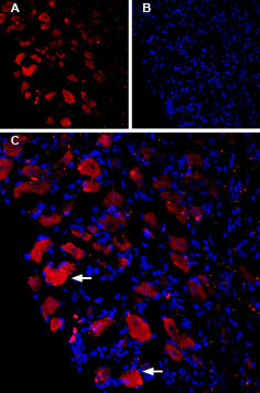 CaV1.3 Antibody in Immunohistochemistry (IHC)