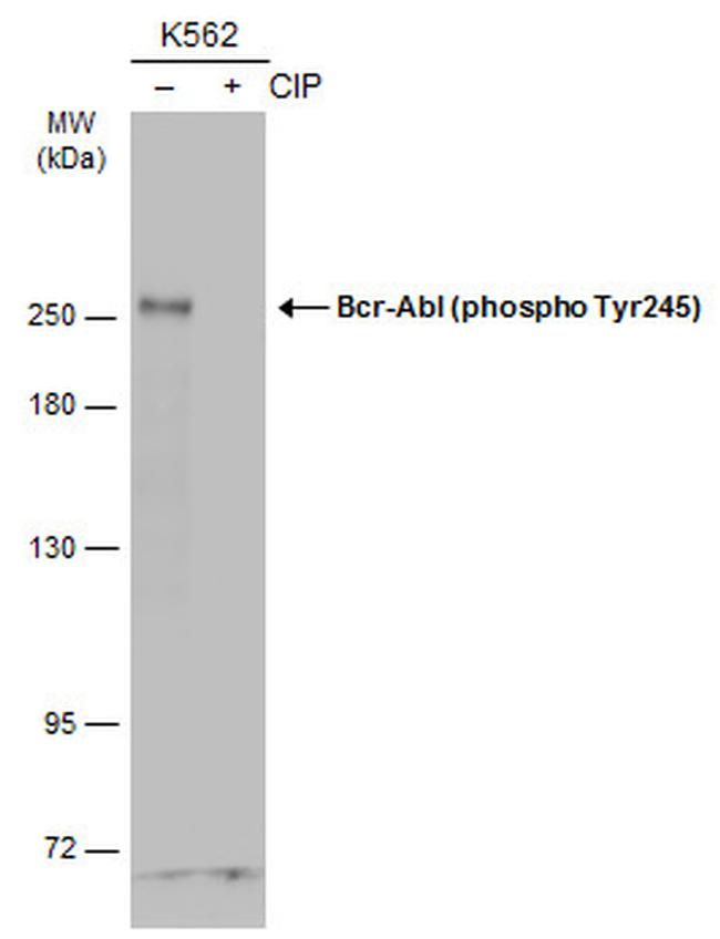 Phospho-c-Abl (Tyr245) Antibody in Western Blot (WB)