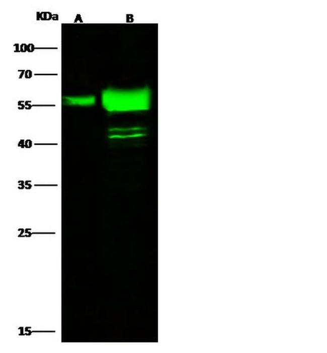 Cytokeratin 7 Antibody in Western Blot (WB)