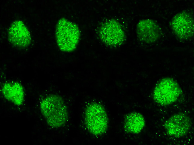 GCM2 Antibody in Immunocytochemistry (ICC/IF)