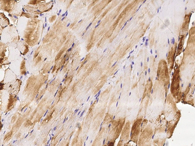 HSPB7 Antibody in Immunohistochemistry (Paraffin) (IHC (P))